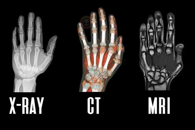 Comparison of X-ray, CT scan, and MRI imaging tests for medical diagnosis